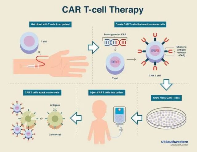 China 1st CAR-T therapy: Patient's cancer cells were cleared in two months