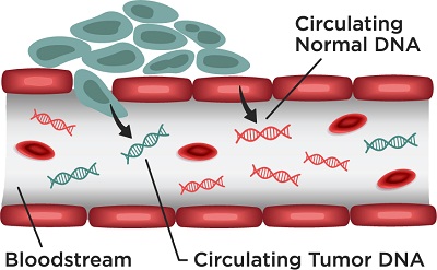 游离dna的发现让肿瘤检测大不同