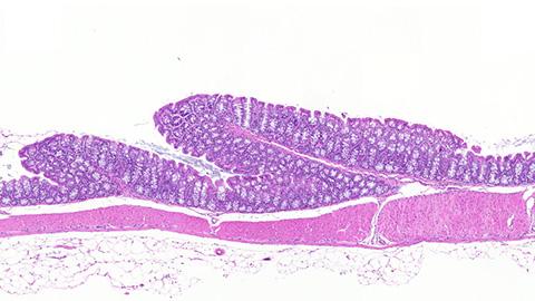 移植了cd4-creerafl/fl小鼠t细胞的小鼠结肠切片组织染色图在体外和体