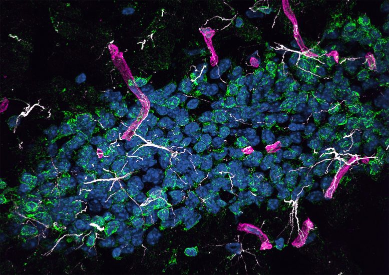 Hippocampal Dentate Gyrus in HSHA Mice