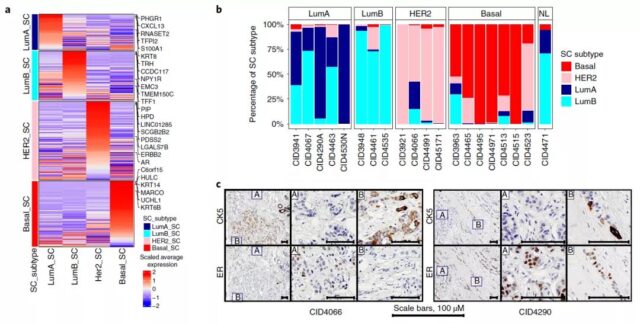 The most comprehensive single-cell spatial map of breast cancer so far