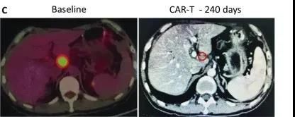 What immunotherapy can treat solid tumors more effectively in future?