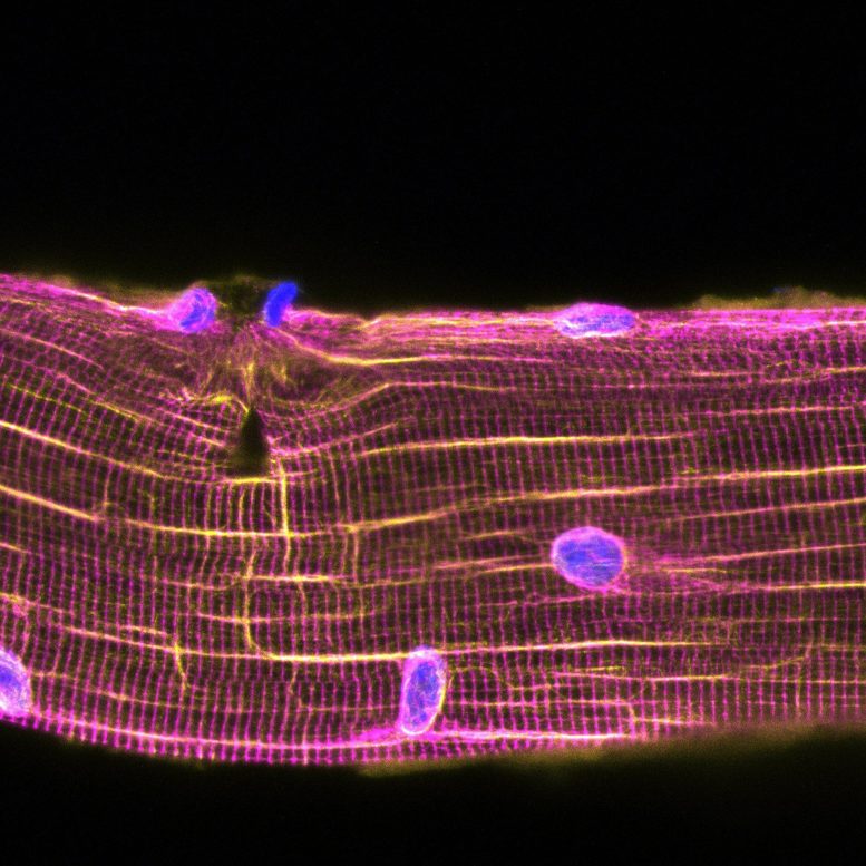 Muscle Lesions Attract Myonuclei To Repair the Damage