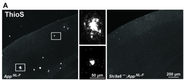 Alzheimer disease: Acidify the intracellular environment to remove amyloid