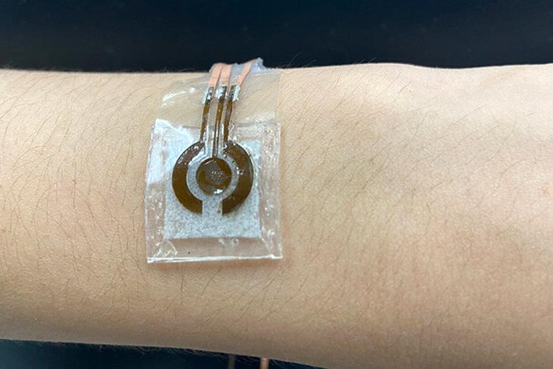 Wearable, Noninvasive Glucose Sensor