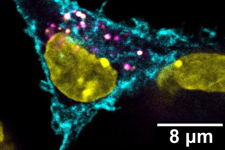 Stealthy Way To Combat Cancer Tumors