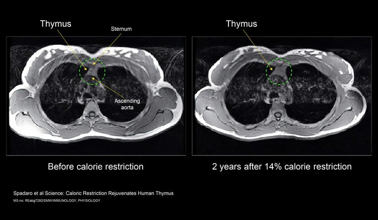 Thymus Calorie Restriction