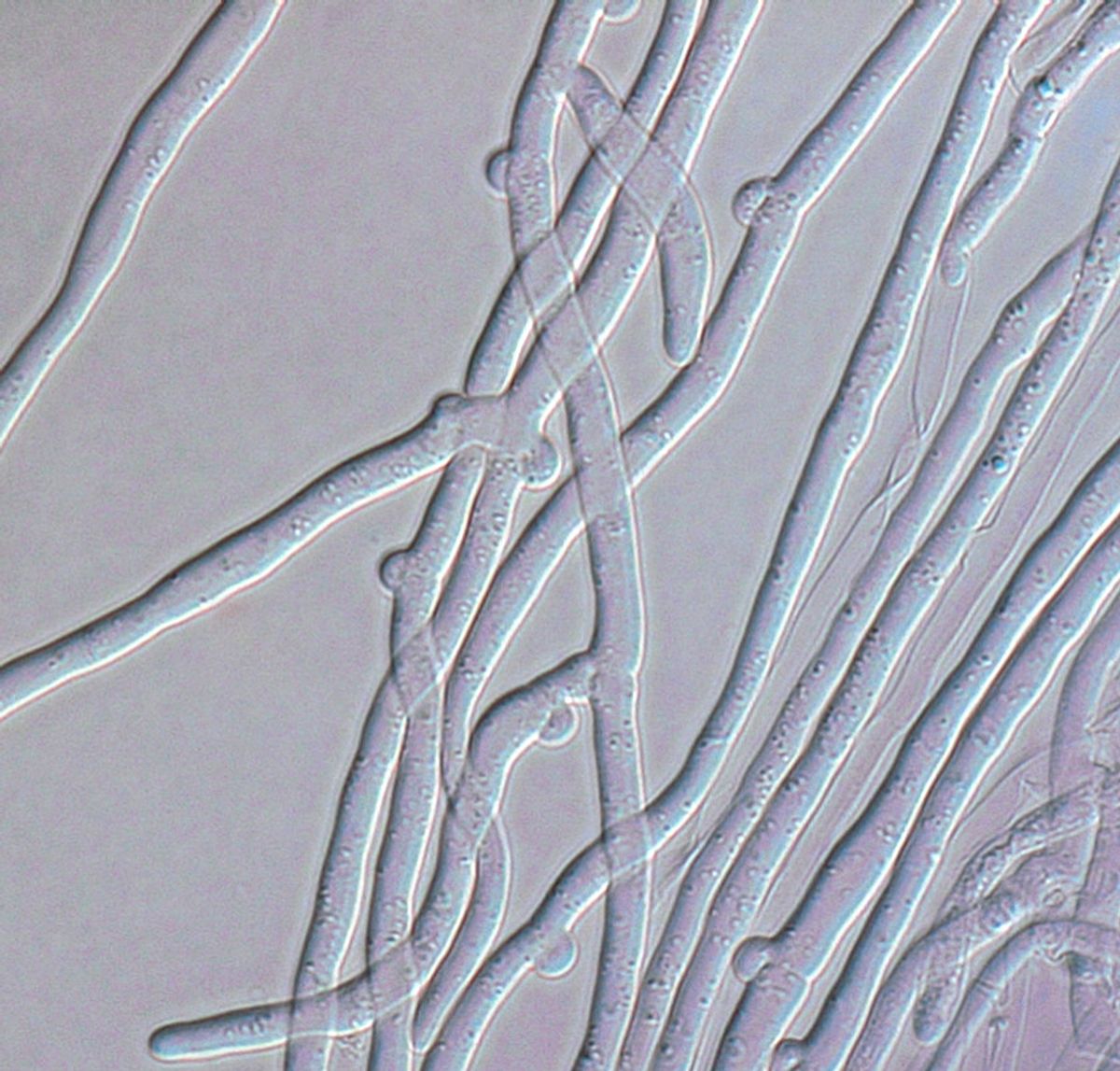microscopic image of joined hyphae
