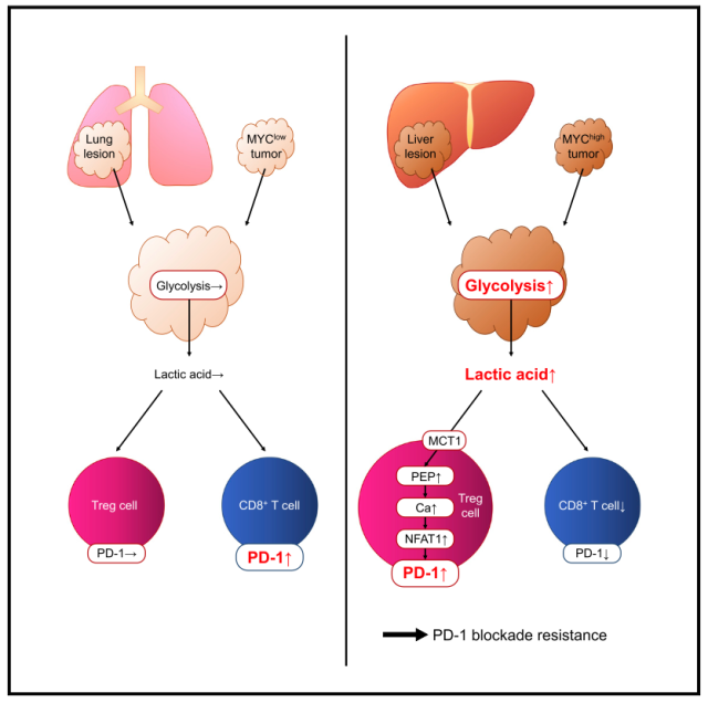 New strategy for tumor immunotherapy: Lactate metabolism in Treg cells