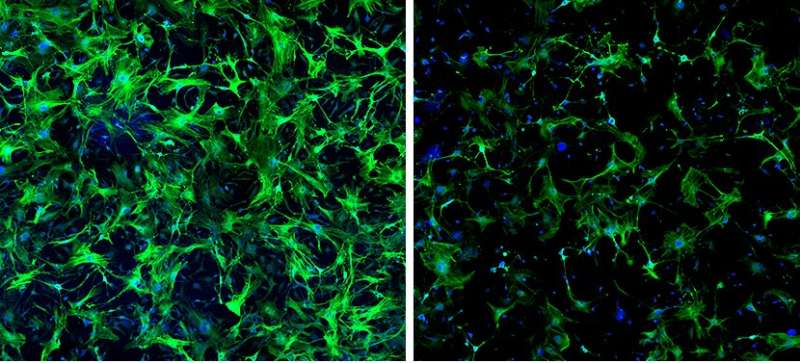 Scientists identify gene that controls scarring in damaged hearts