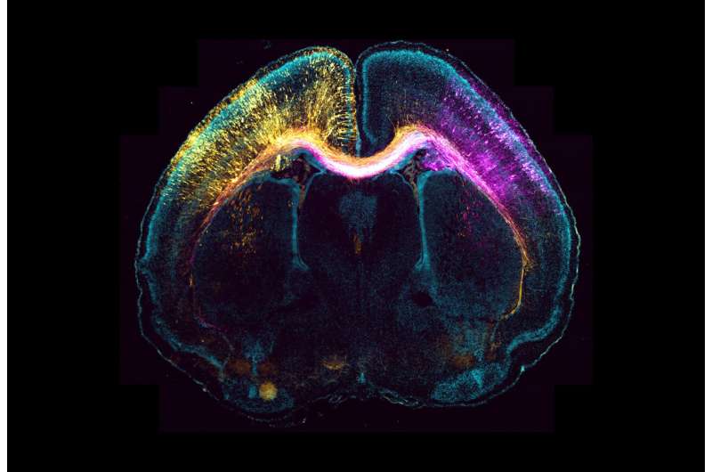 The centrosome plays an important role in neuron migration