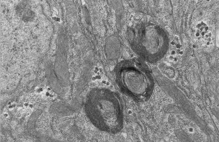 Three PXo bodies in a mature enterocyte of the fly midgut epithelium