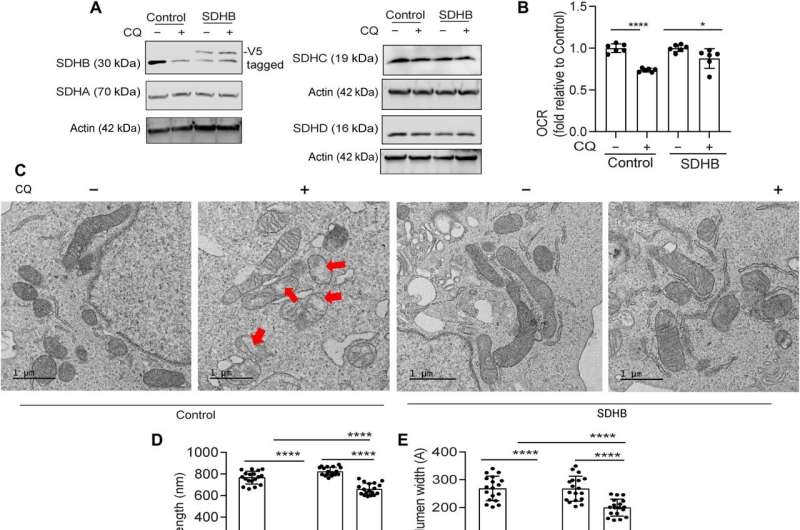 Inhibiting the biological crosstalk of autophagy and mitochondrial function underlying pancreatic ductal adenocarcinoma