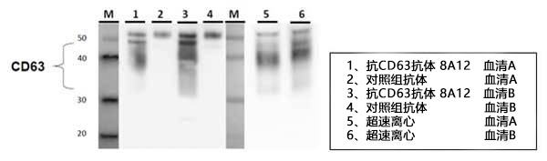 2 CD63（8A12）-汉化.jpg