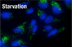 C:\Documents and Settings\kandy\����\��Ѷ14\ͼ\starvation.gif