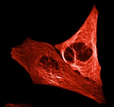 科学家成功研制新的细胞成像工具红色荧光蛋白