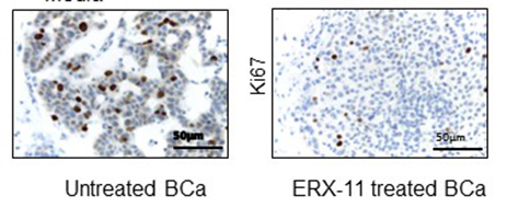 ER阳性乳腺癌新药——ERX-11