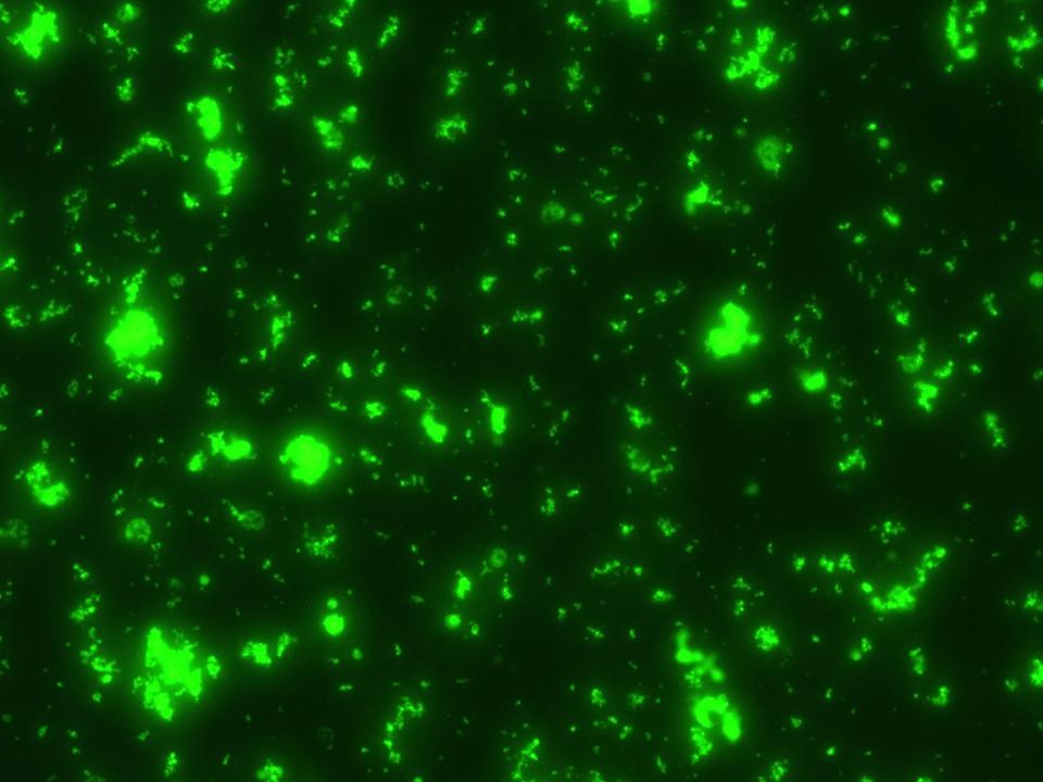 重庆大学Nature子刊发表耐药研究首发性成果